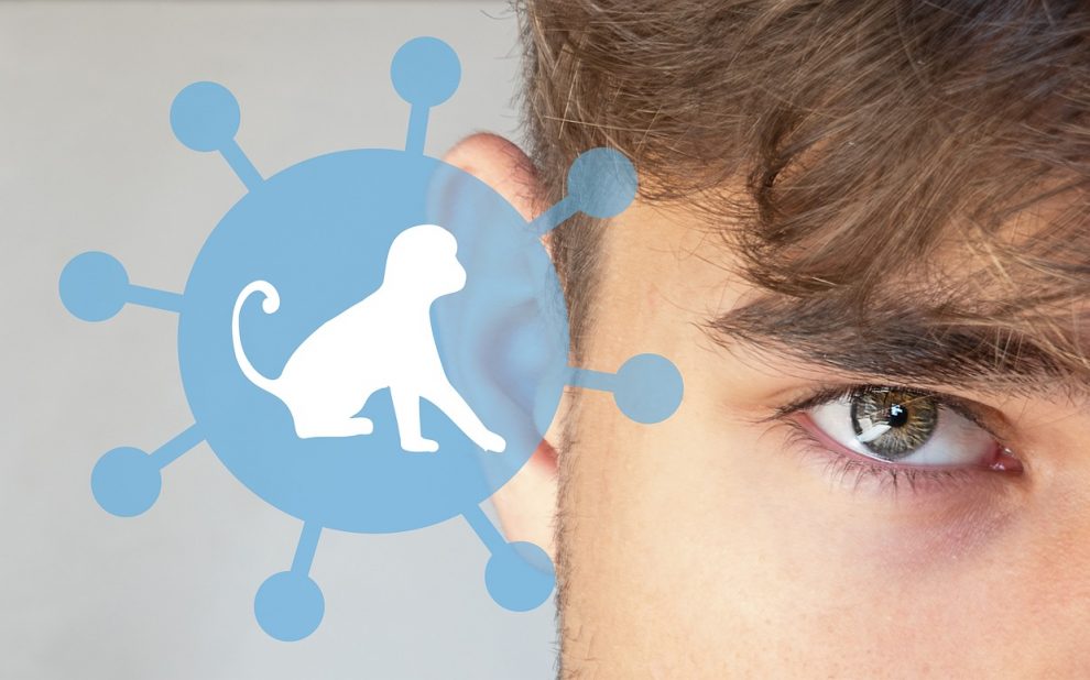 monkey pox 7224615 1280