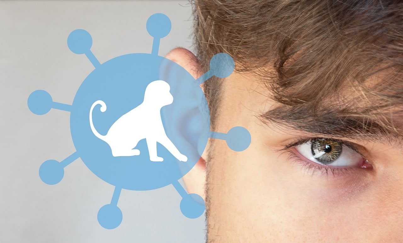 monkey pox 7224615 1280